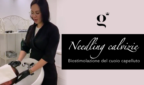 biostimolzione-cuoio-capelluto-youtube