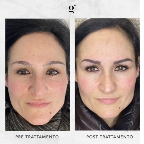 microblading-greta-estetica-avanzata